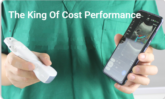 The-King-Of-Cost-Performance